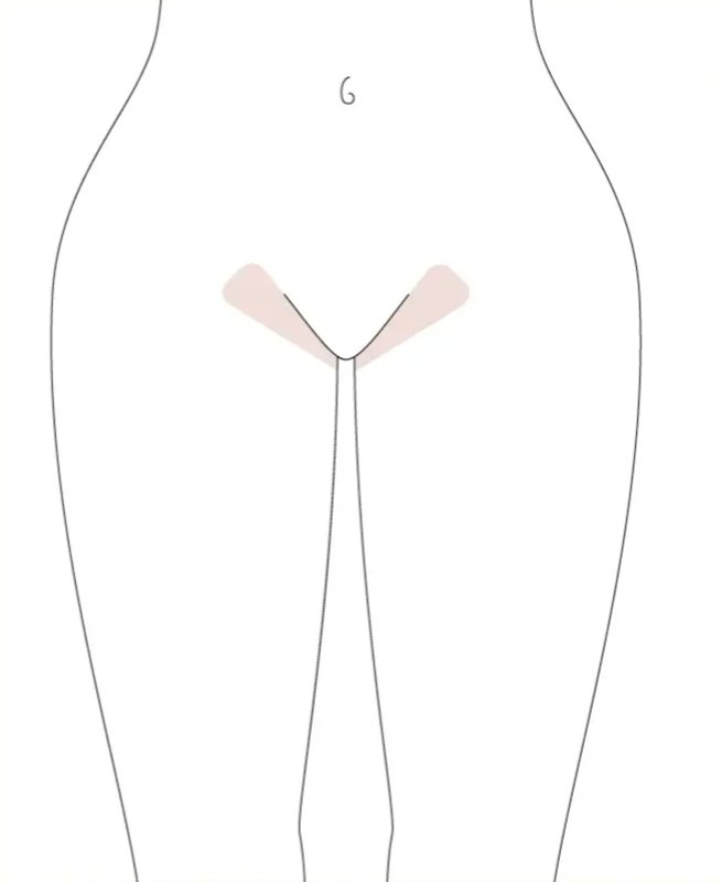 Diagram shading the two sides of the bikini line, the area a bikini wax covers at TLC Nails and Esthetics in Nottingham, MD