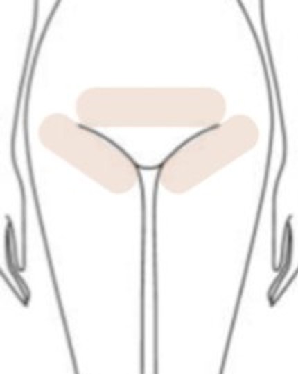 Line drawing of the hips and upper thighs from the front, with a shaded band across the lower front and shading along each hip crease carrying down onto the tops of both thighs, the wider area an extended bikini wax covers at TLC Nails and Esthetics in Nottingham, MD